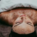 How to address common skin issues with holistic approaches