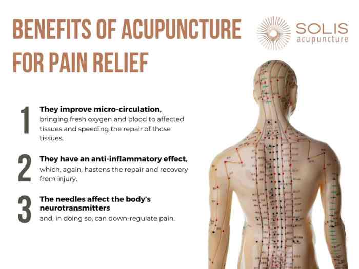 Acupuncture for arthritis pain relief